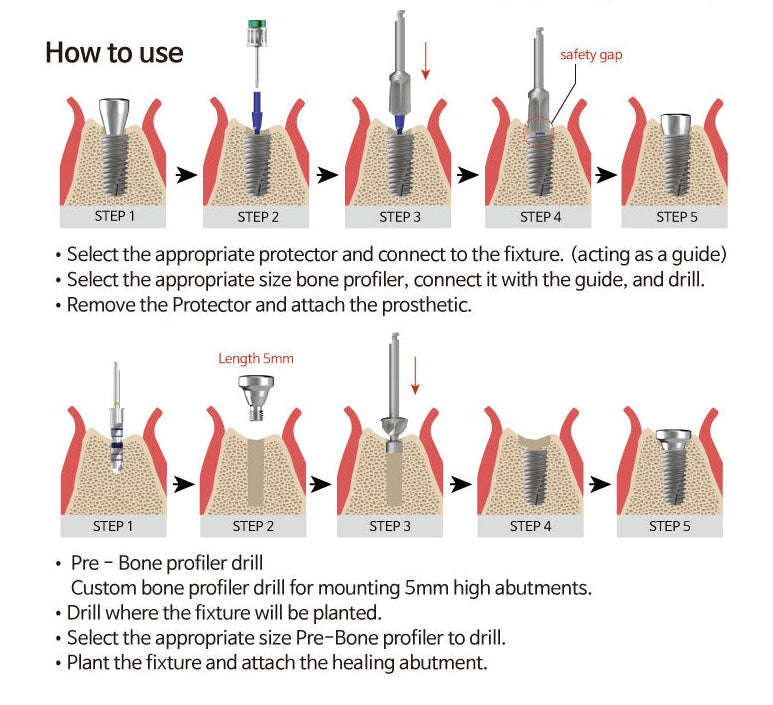 Bone Profiler Kit: Made by Dr. Youngsam Kim