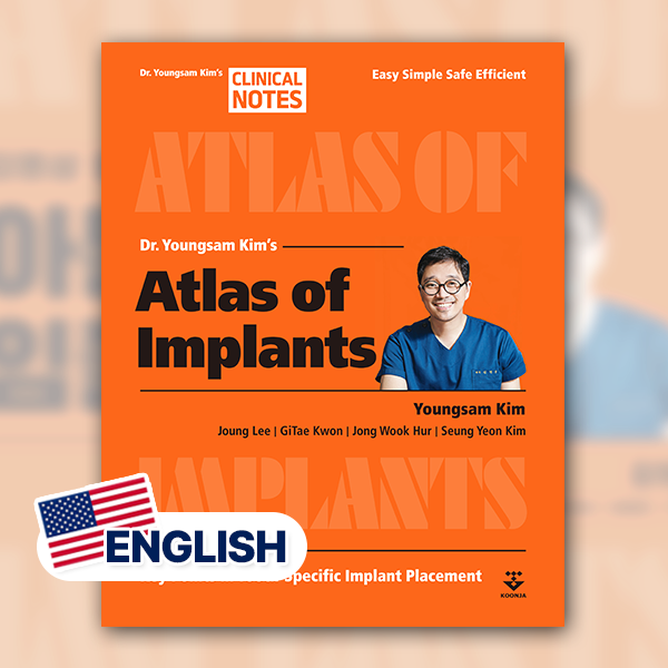 Atlas of Implants (English)