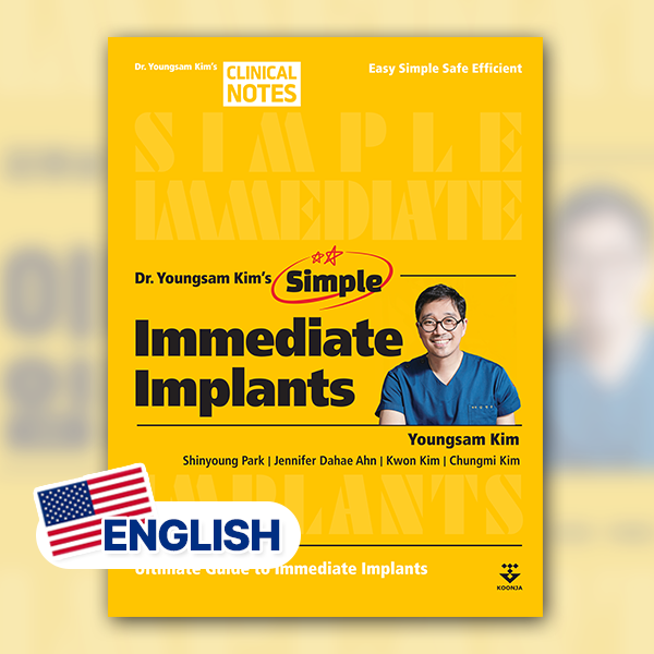 Simple Immediate Implants (English)