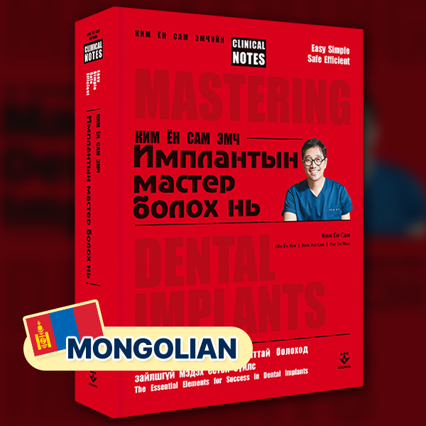 Mastering Dental Implants: The Essential Elements for Success in Dental Implants (Mongolian)